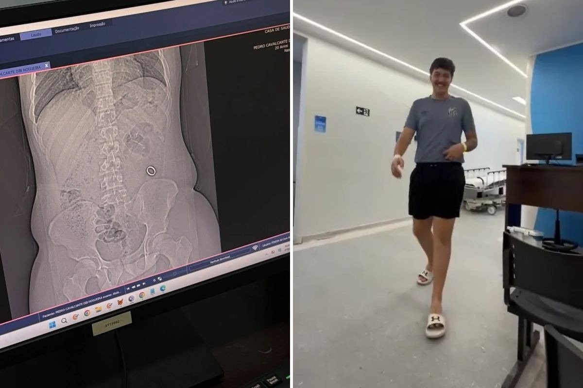 Jovem engole a própria aliança sem querer e vídeo viraliza